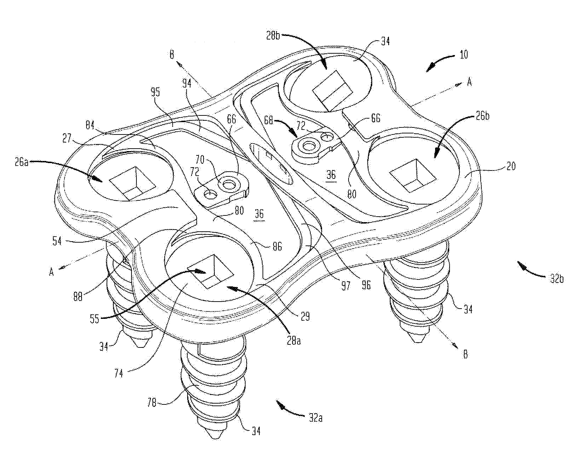 Cervical plate with a feedback device for selective association with bone screw blocking mechanism