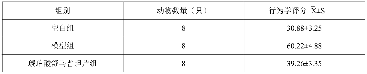 Use of human urinary kininogenase in preparation of medicine for treating migraine and its composition