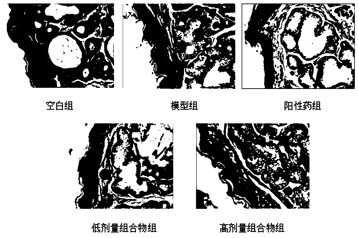 Composition for treating acute pharyngitis and application