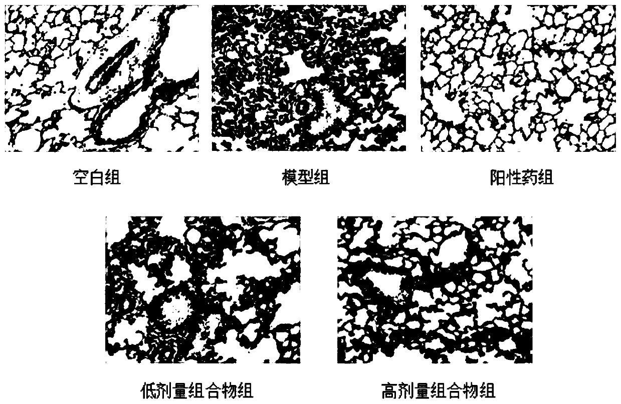 Composition for treating acute pharyngitis and application