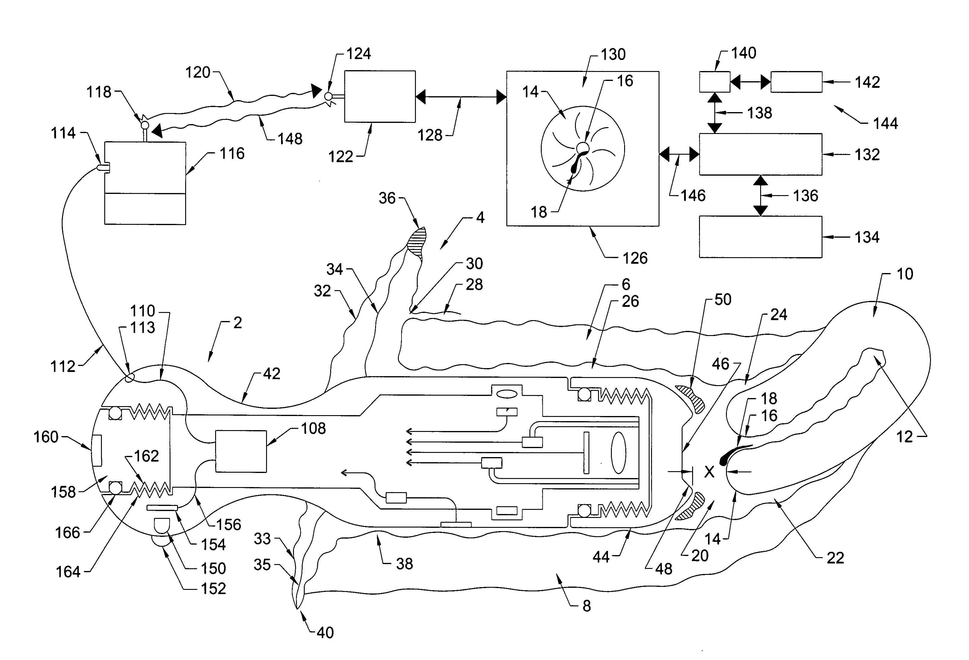 Slotted elongated tubular shaped personal pelvic viewer for simultaneously examining the paraurethral sponge, the skene's glands, and the urethra