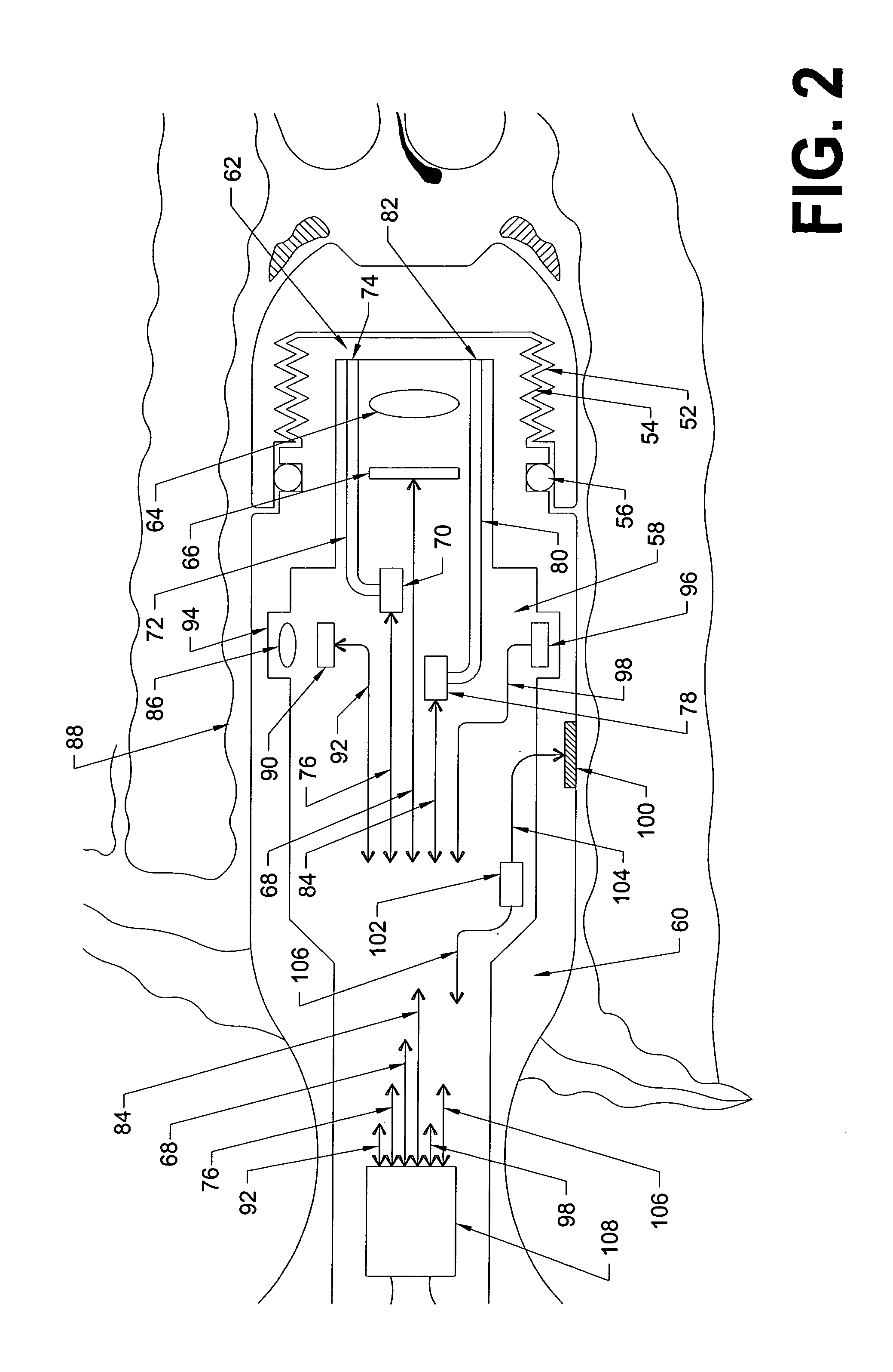 Slotted elongated tubular shaped personal pelvic viewer for simultaneously examining the paraurethral sponge, the skene's glands, and the urethra