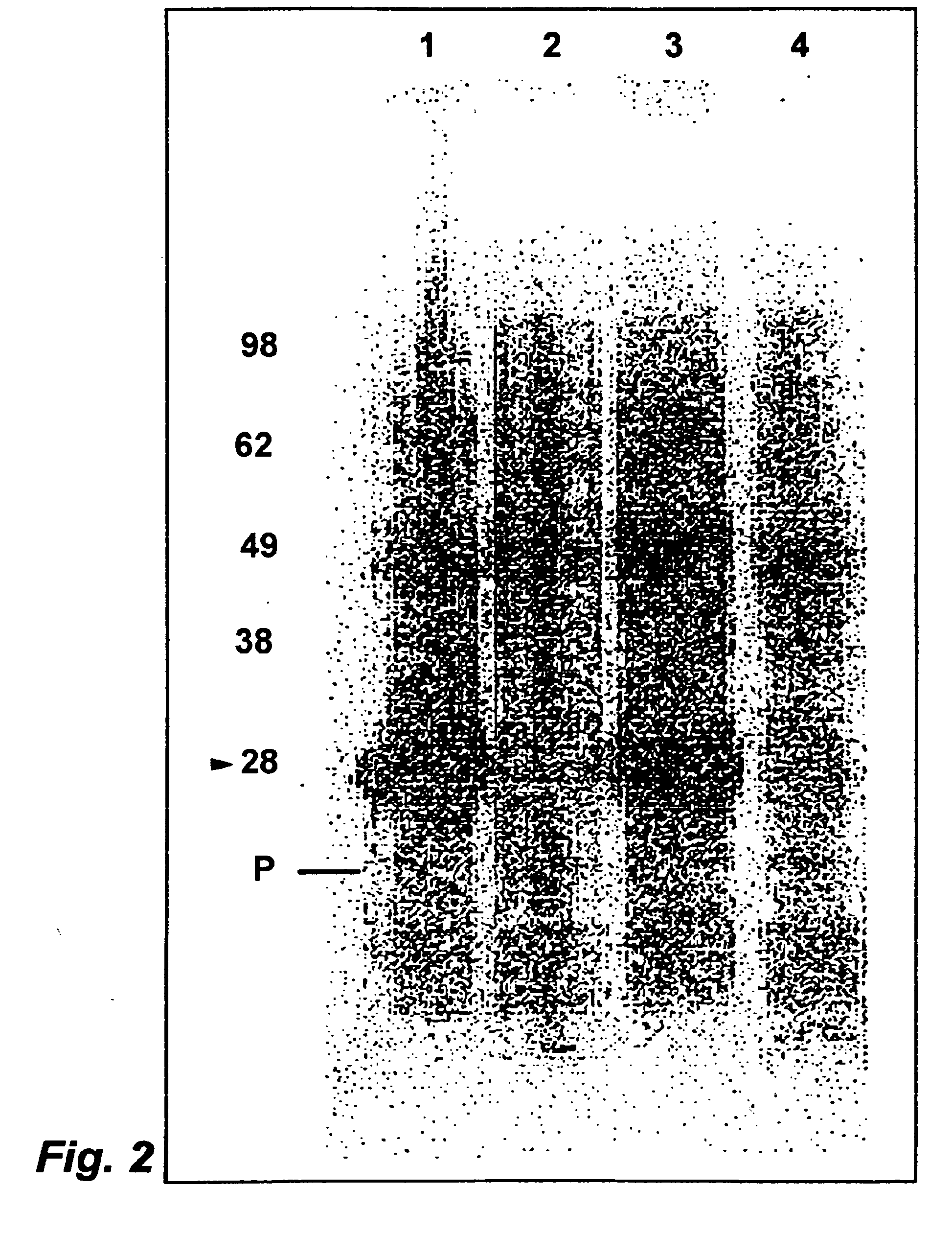 Compositions and Methods for Enhanced Somatostatin Immunogenicity in the Treatment of Growth Hormone and Insulin-Like Growth Factor One Deficiency