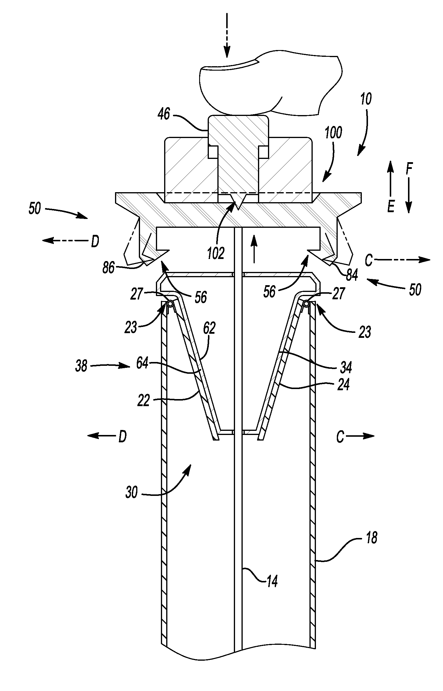 Fluid reservoir assembly