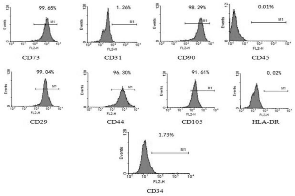 A kind of stem cell conditioned medium, its preparation method and application