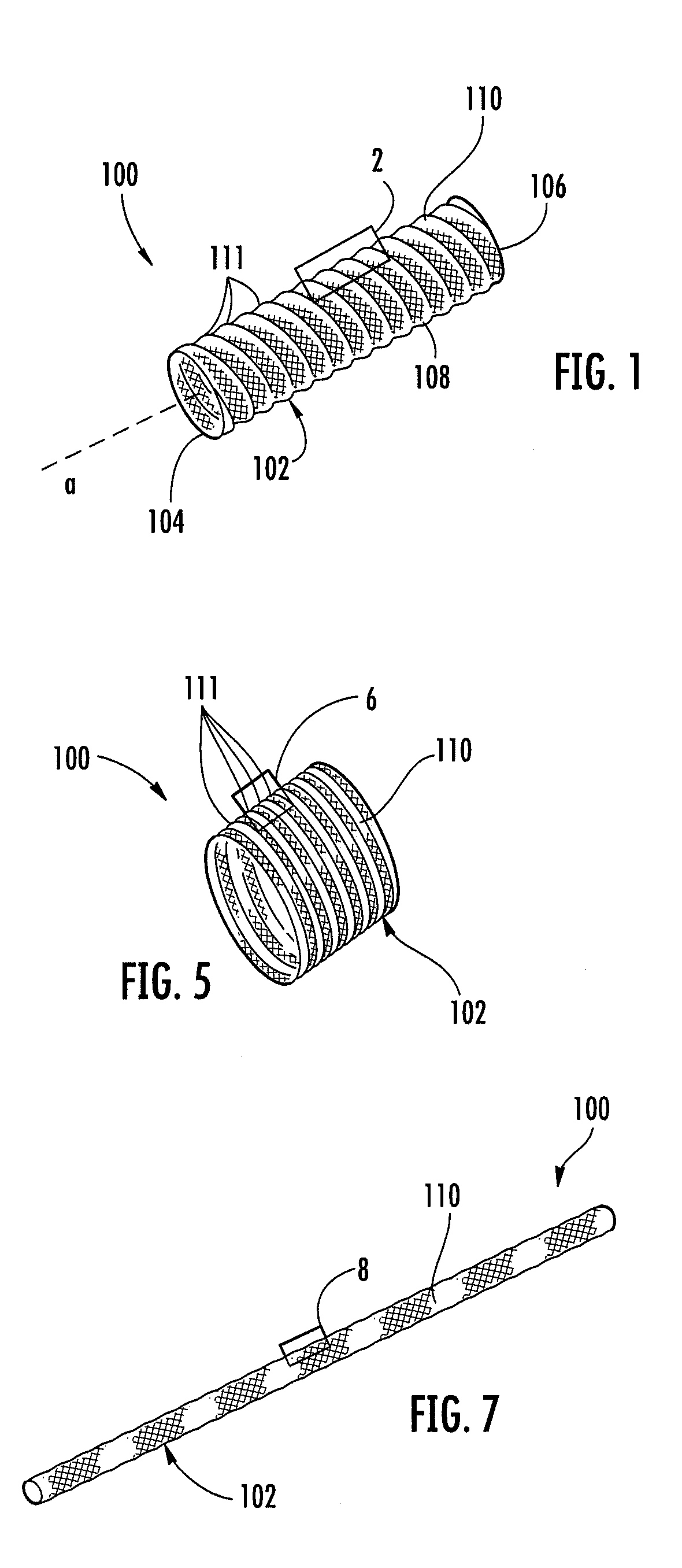 Medical device including corrugated braid and associated method