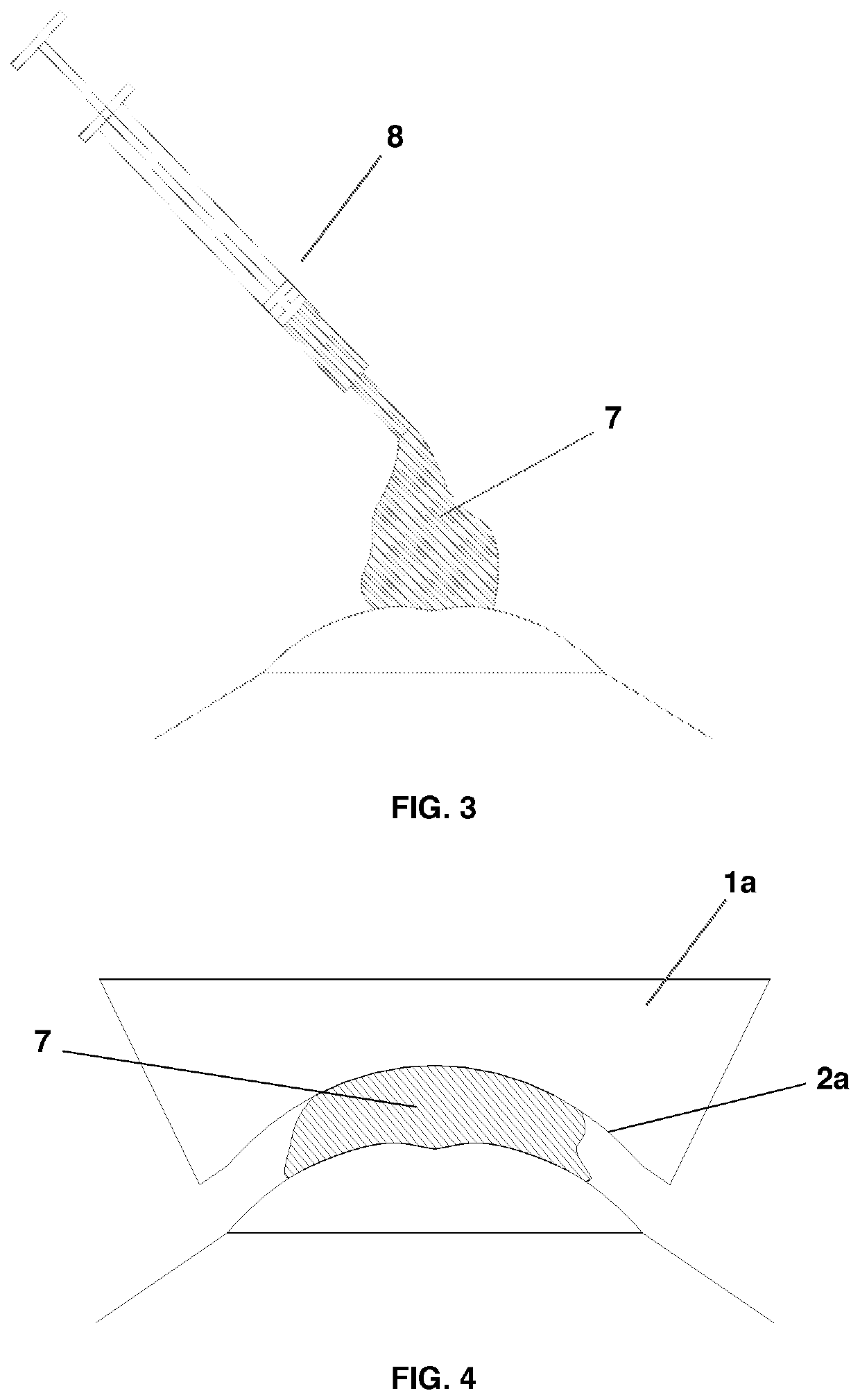 System for correcting an irregular surface of a cornea and uses thereof