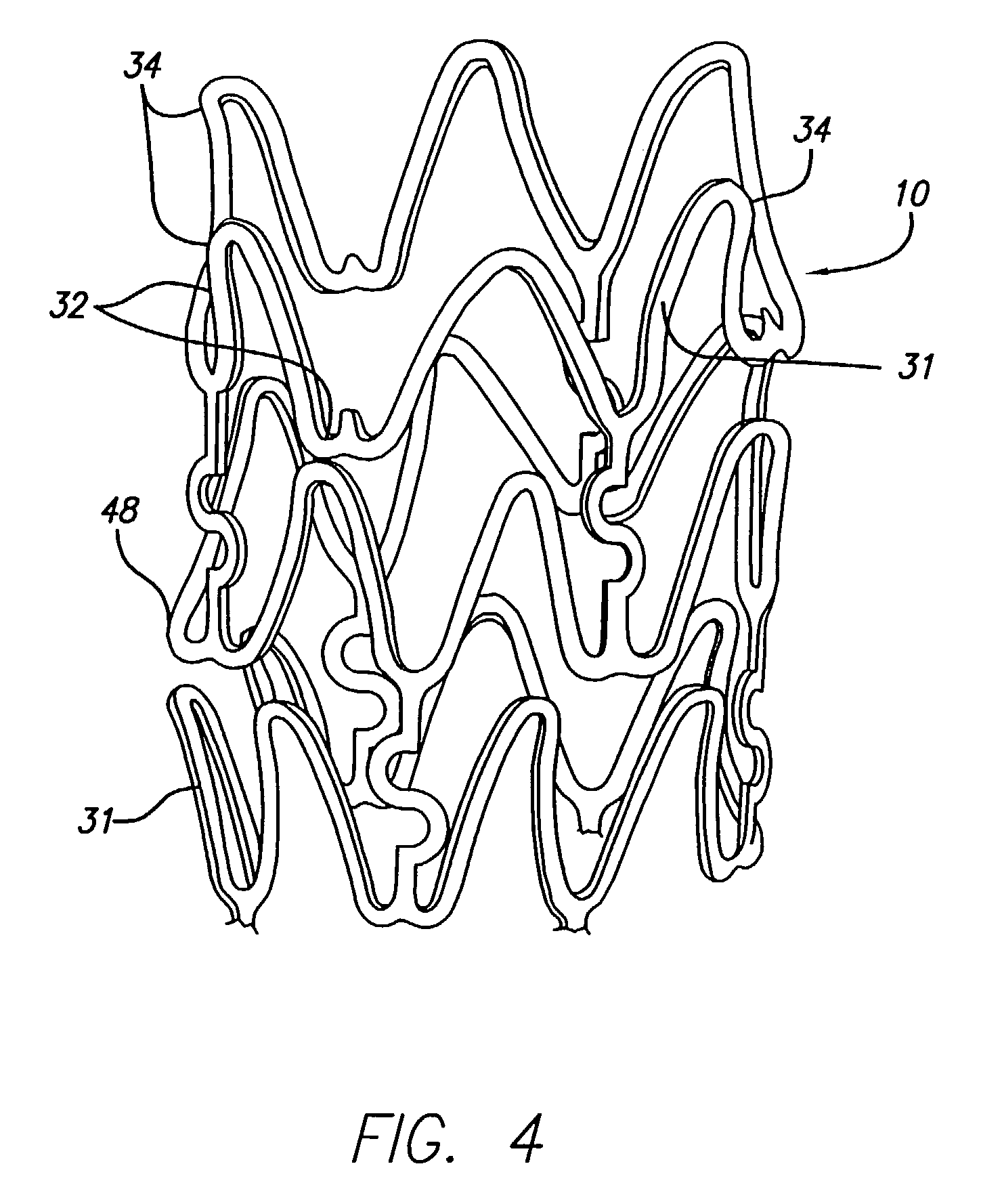Polymer link hybrid stent
