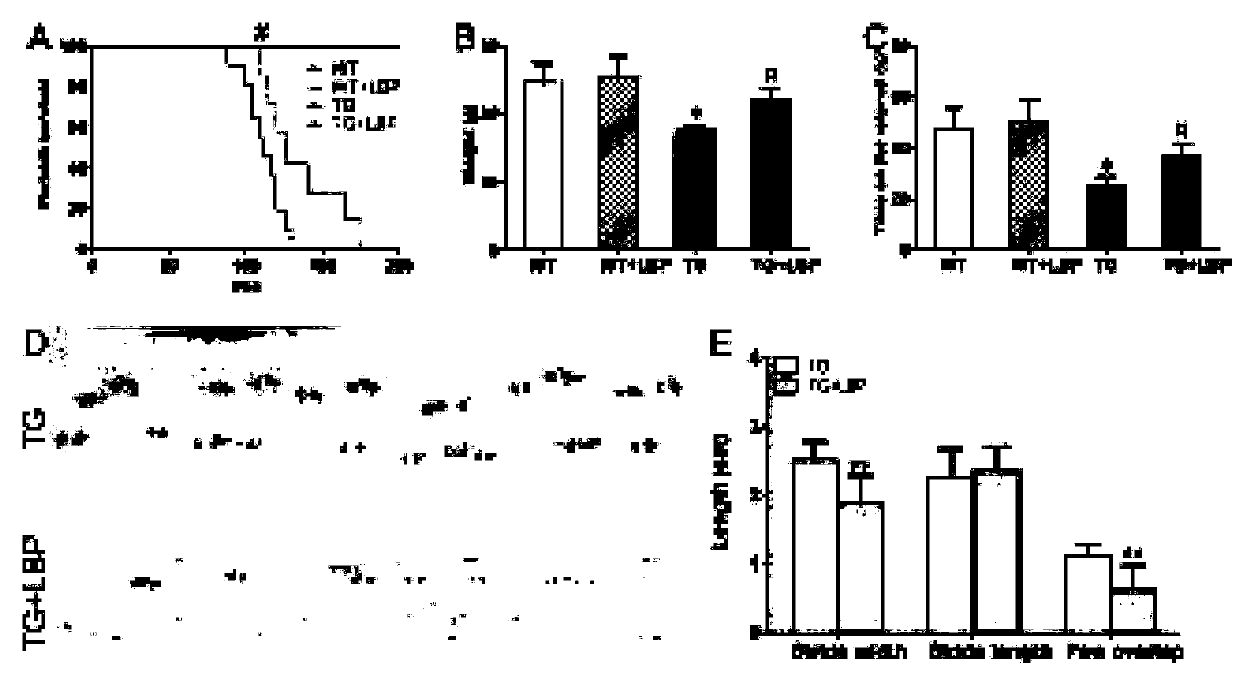 Application of lycium barbarum polysaccharide to preparation of medicament or health-care product for repairing damaged nerves