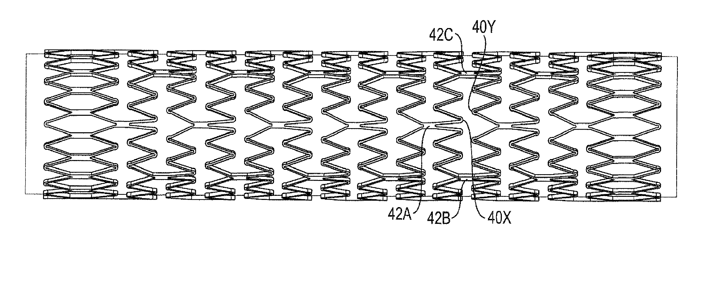 Bend-Capable Stent Prosthesis