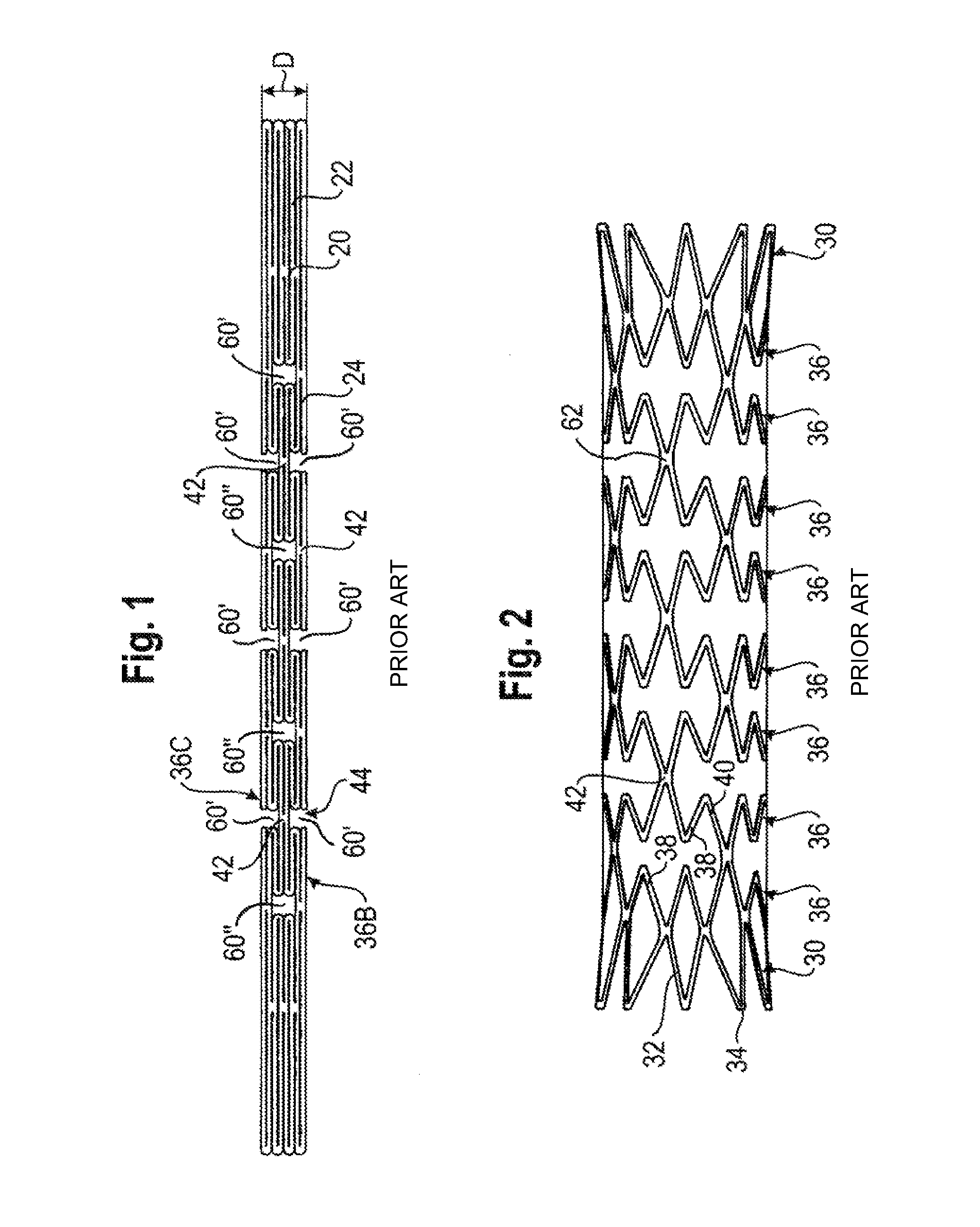 Bend-Capable Stent Prosthesis