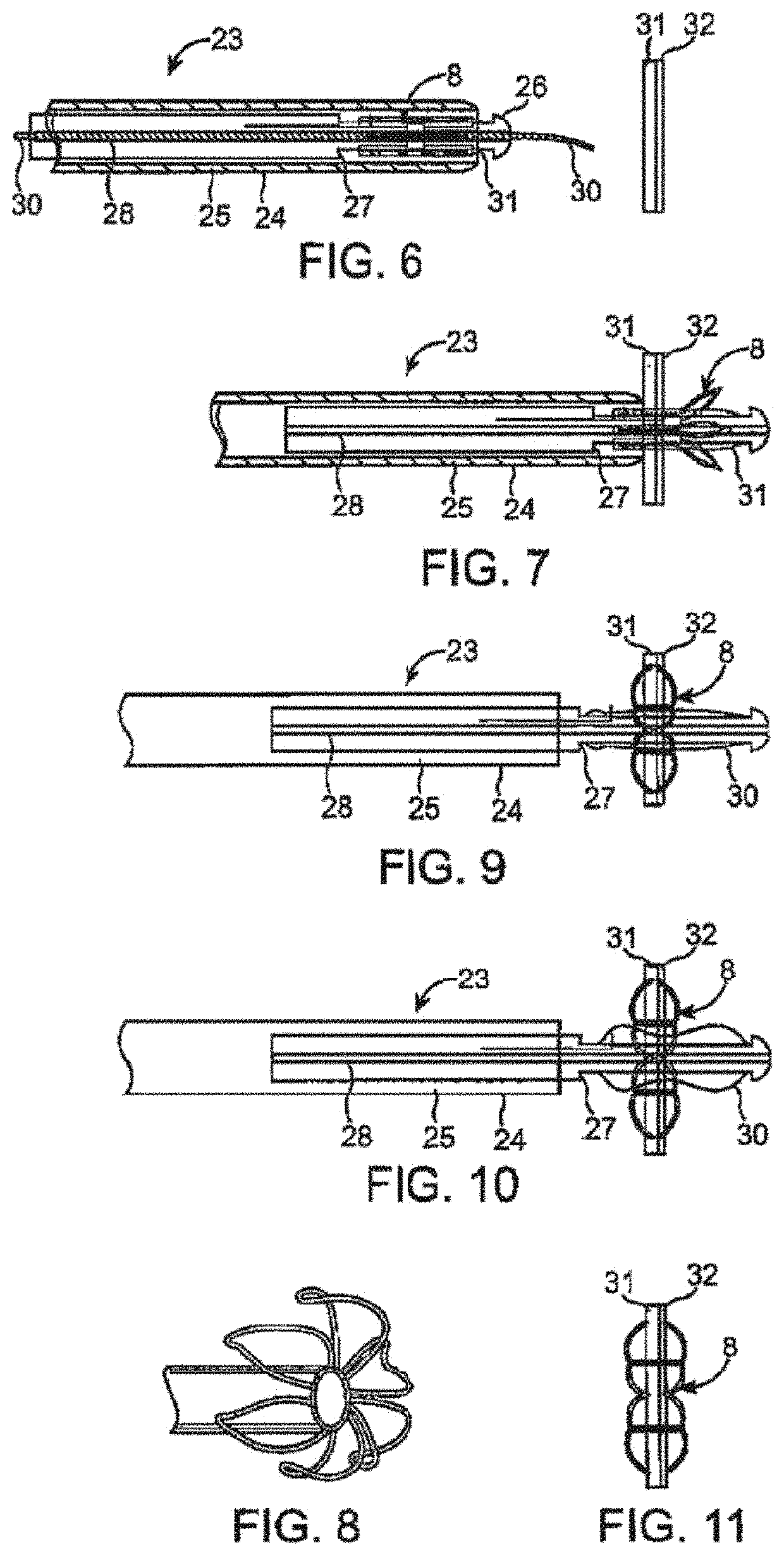 Device and method for establishing an artificial arterio-venous fistula