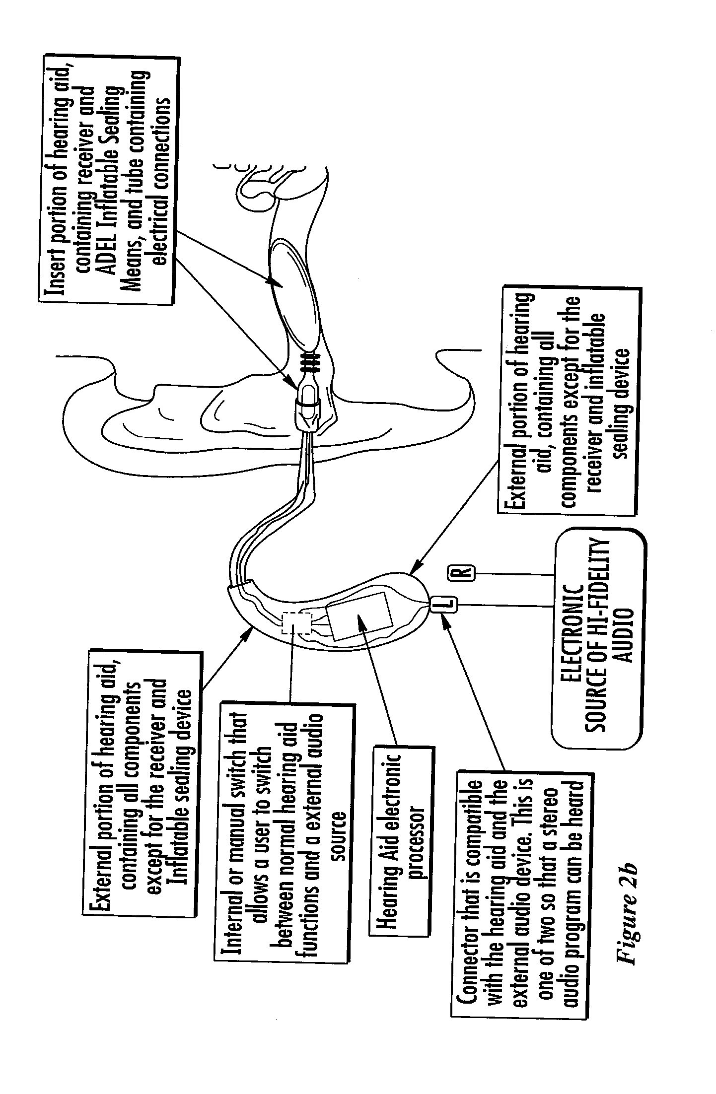 Hearing Device System and Method