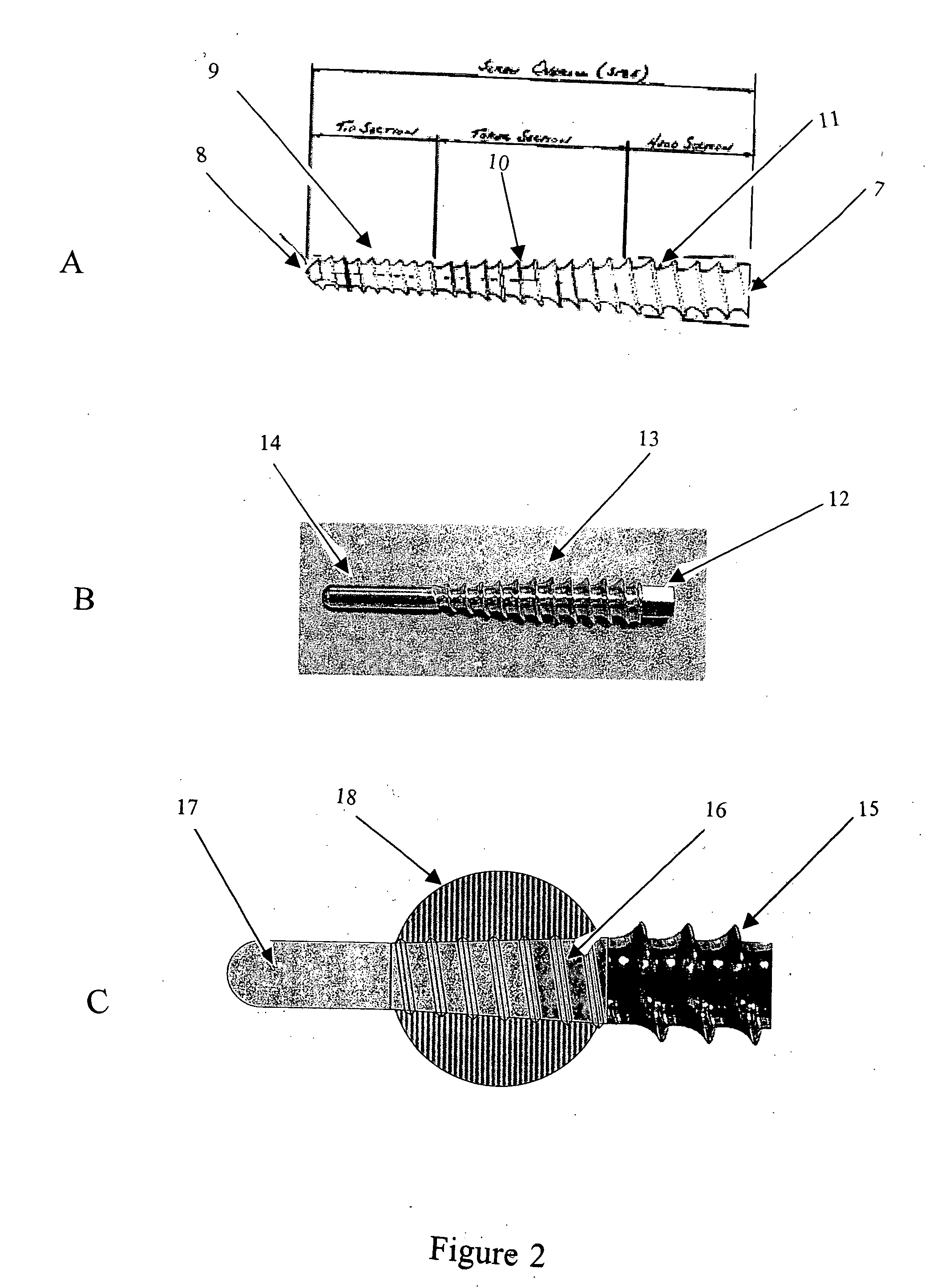 Devices and methods for interlocking surgical screws and nails
