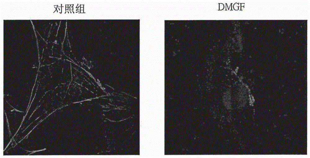 Neoplasm metastasis suppressing pharmaceutical composition prepared by DMGF (7,7''-Dimethoxyagastisflavone) and application of neoplasm metastasis suppressing pharmaceutical composition