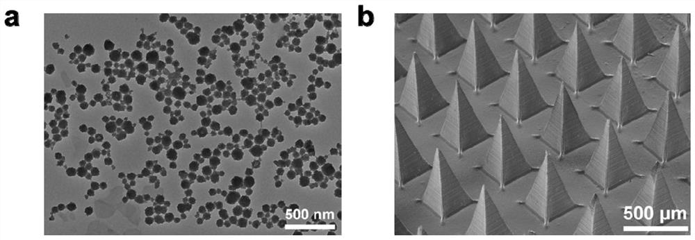 Microneedle patch for enhancing accumulation of protoporphyrin IX in solid tumor and preparation method of microneedle patch