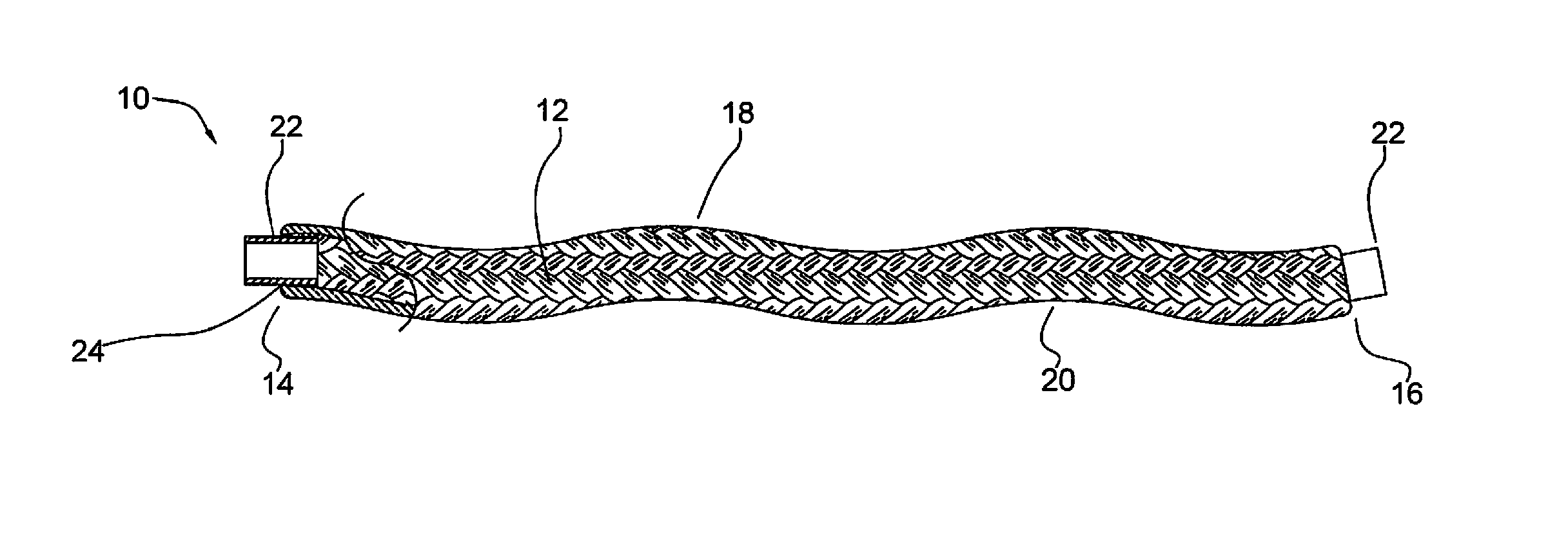 Micrograft for the treatment of intracranial aneurysms and method for use