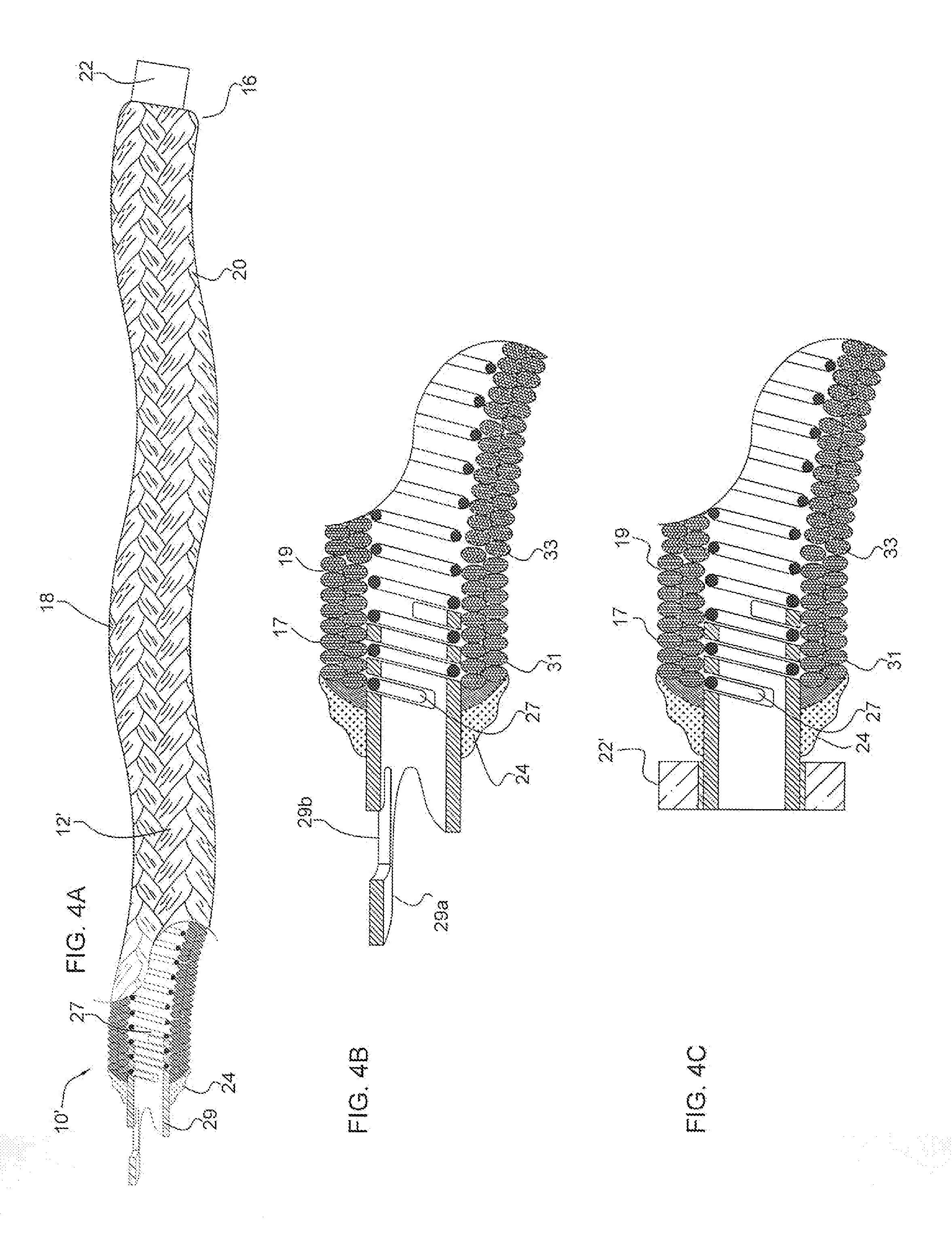 Micrograft for the treatment of intracranial aneurysms and method for use