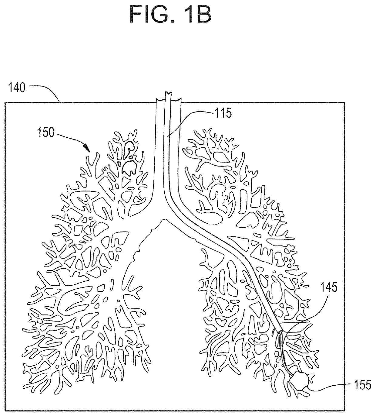 Systems and methods for  liquid flooding of lung to enhance endobronchial energy transfer for use in imaging, diagnosis and/or treatment