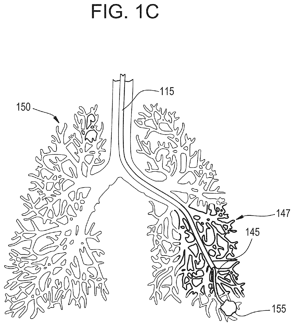 Systems and methods for  liquid flooding of lung to enhance endobronchial energy transfer for use in imaging, diagnosis and/or treatment