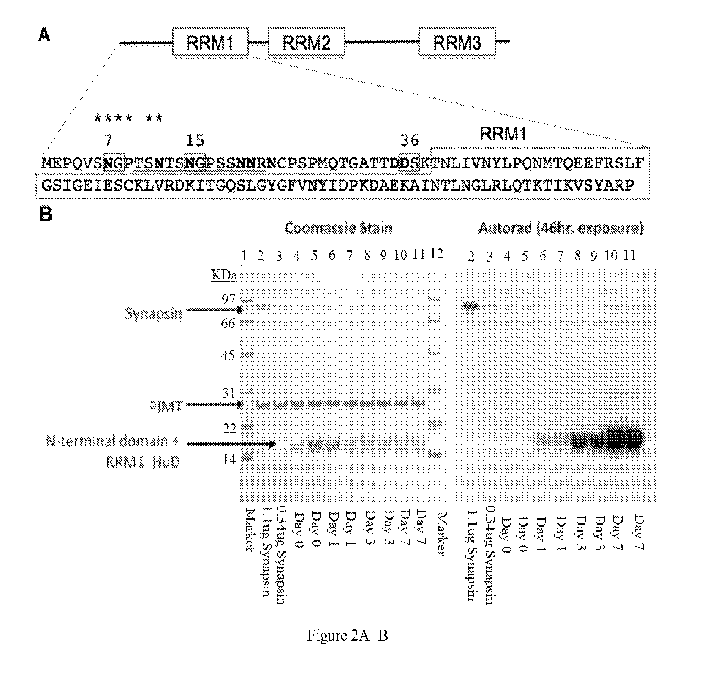 Methods and Compositions for Detecting, Imaging, and Treating Small Cell Lung Cancer Utilizing Post-Translationally Modified Residues and Higher Molecular Weight Antigenic Complexes in Proteins