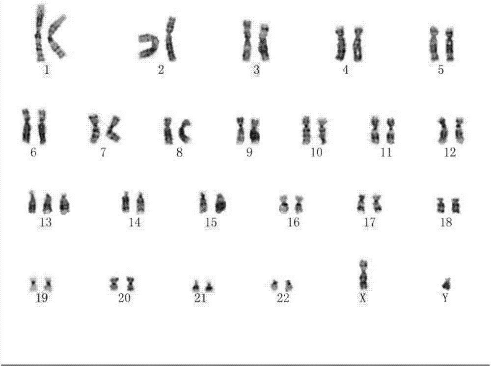 Human prostate cancer cell as well as passage separation culture and subculturing culture method and application thereof