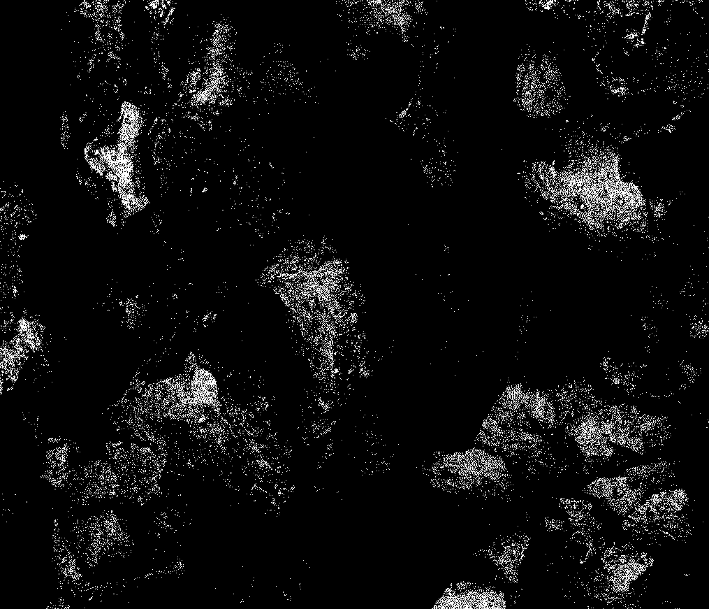 Collagen coralline hydroxyapatite composite bone filling scaffold material and material preparation method thereof