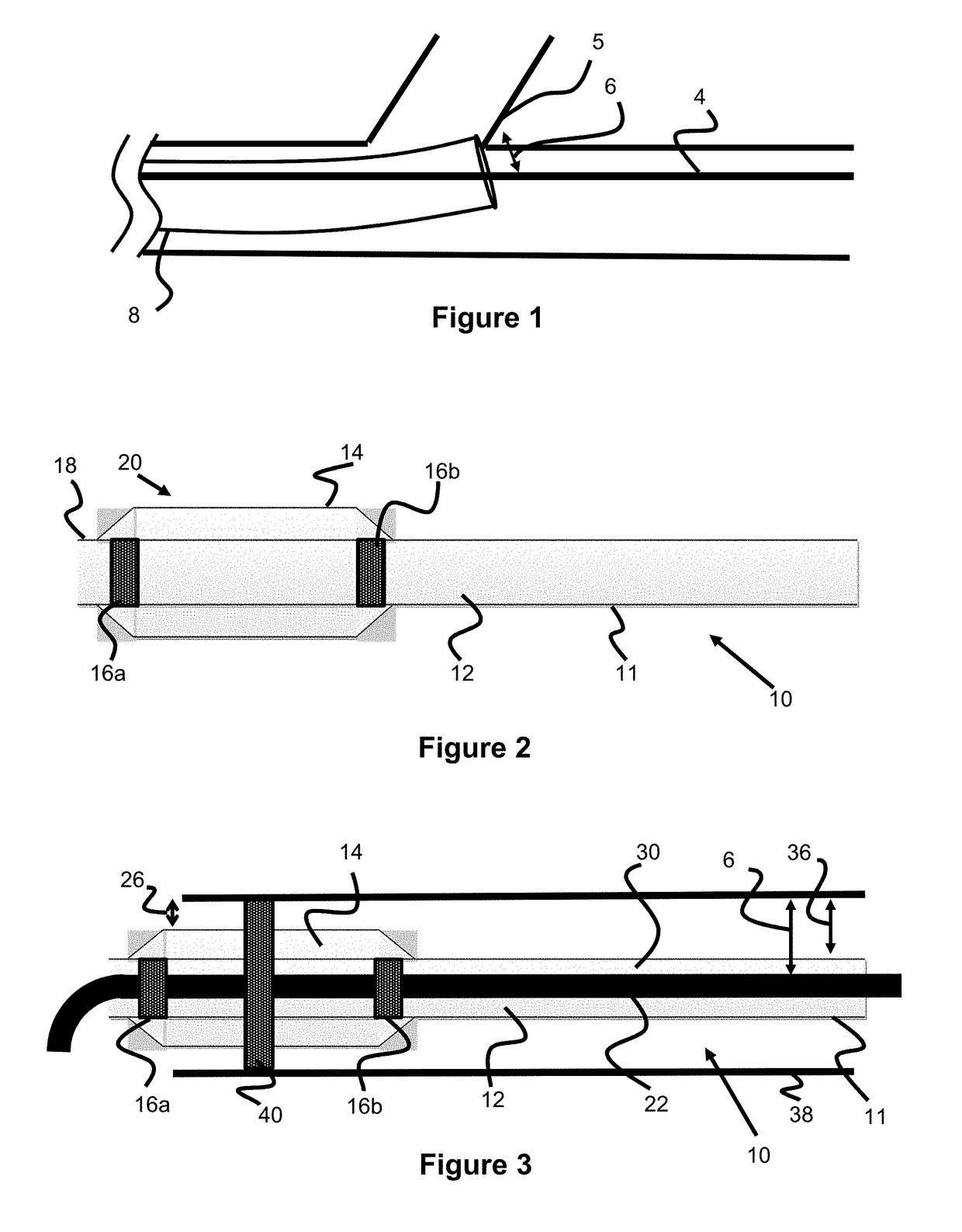 Intravascular Treatment Devices And Methods