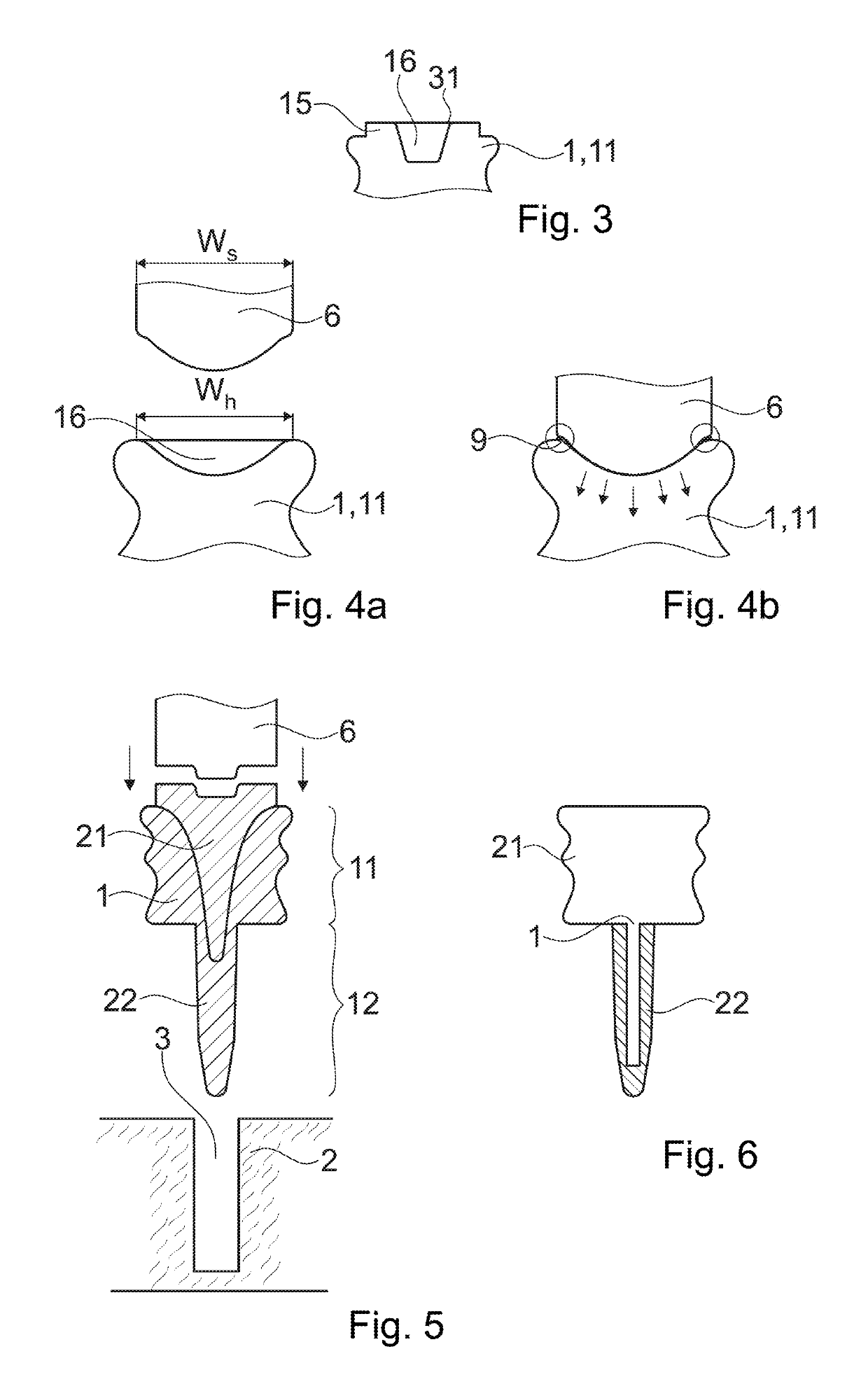 Anchoring a joining element in an object