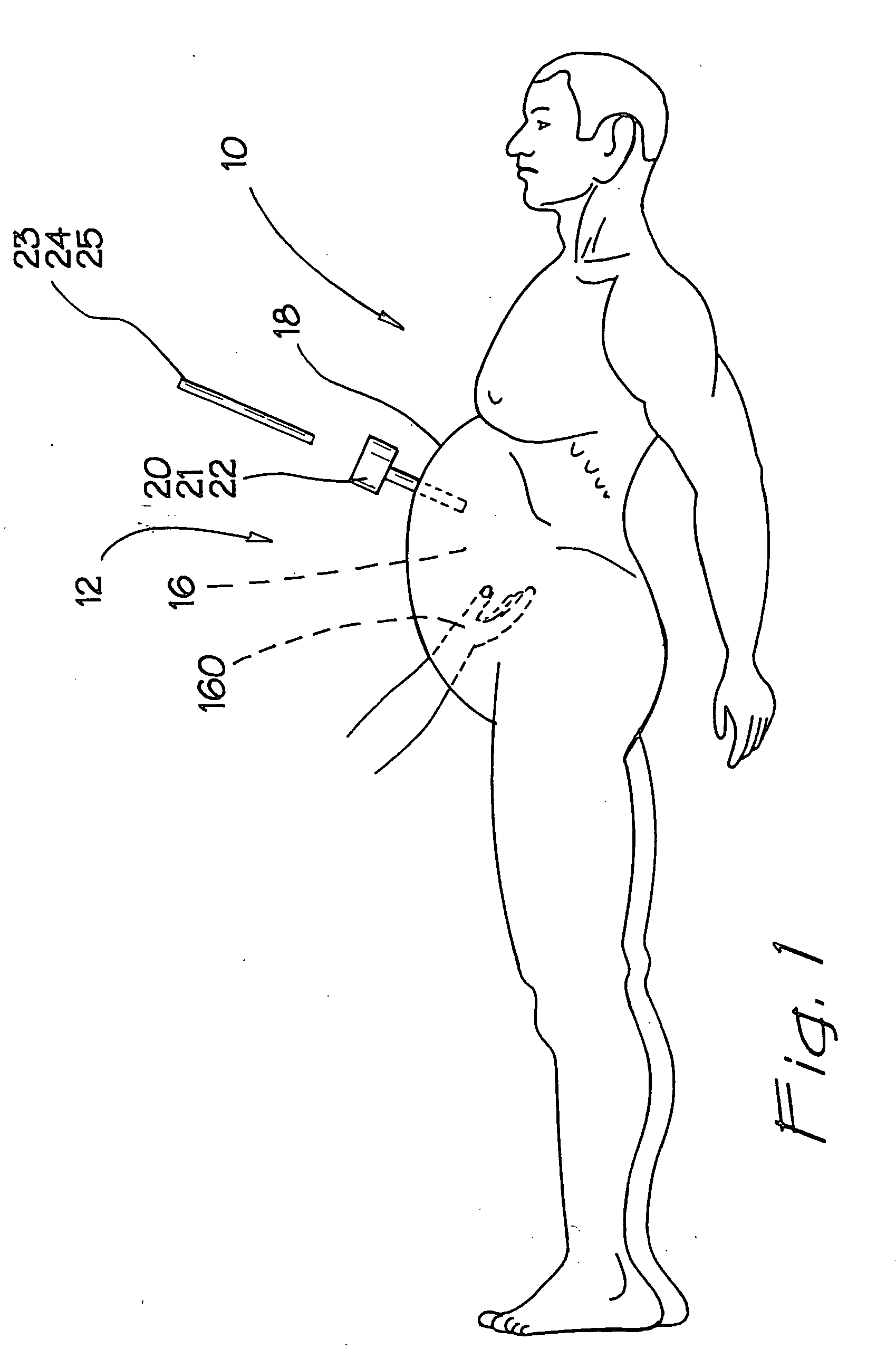 Sealed surgical access device