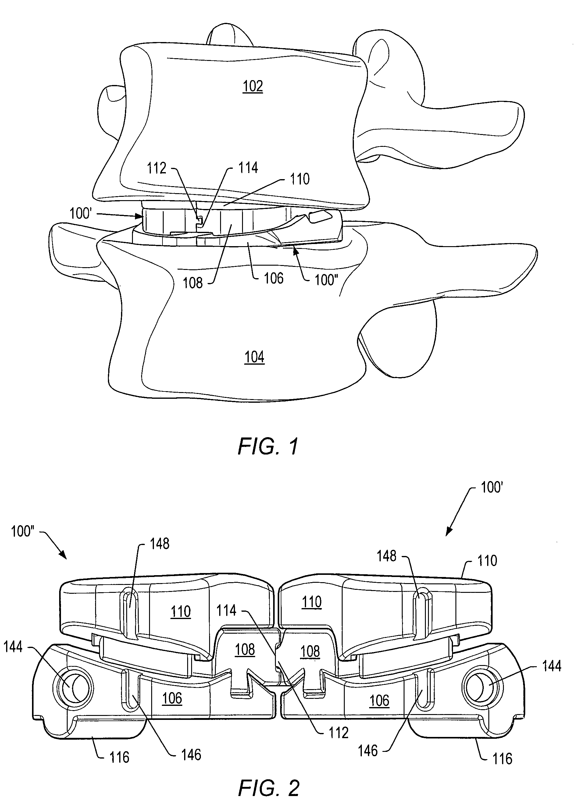 Dampener system for a posterior stabilization system with a fixed length elongated member