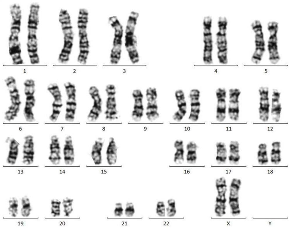 Optimal chromosome karyotype map splicing method, optimal chromosome karyotype map splicing system and chromosome karyotype analysis method
