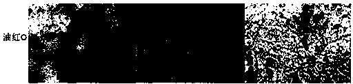 Preparation of a trace, efficient and stable triglyceride detection kit in adipocytes