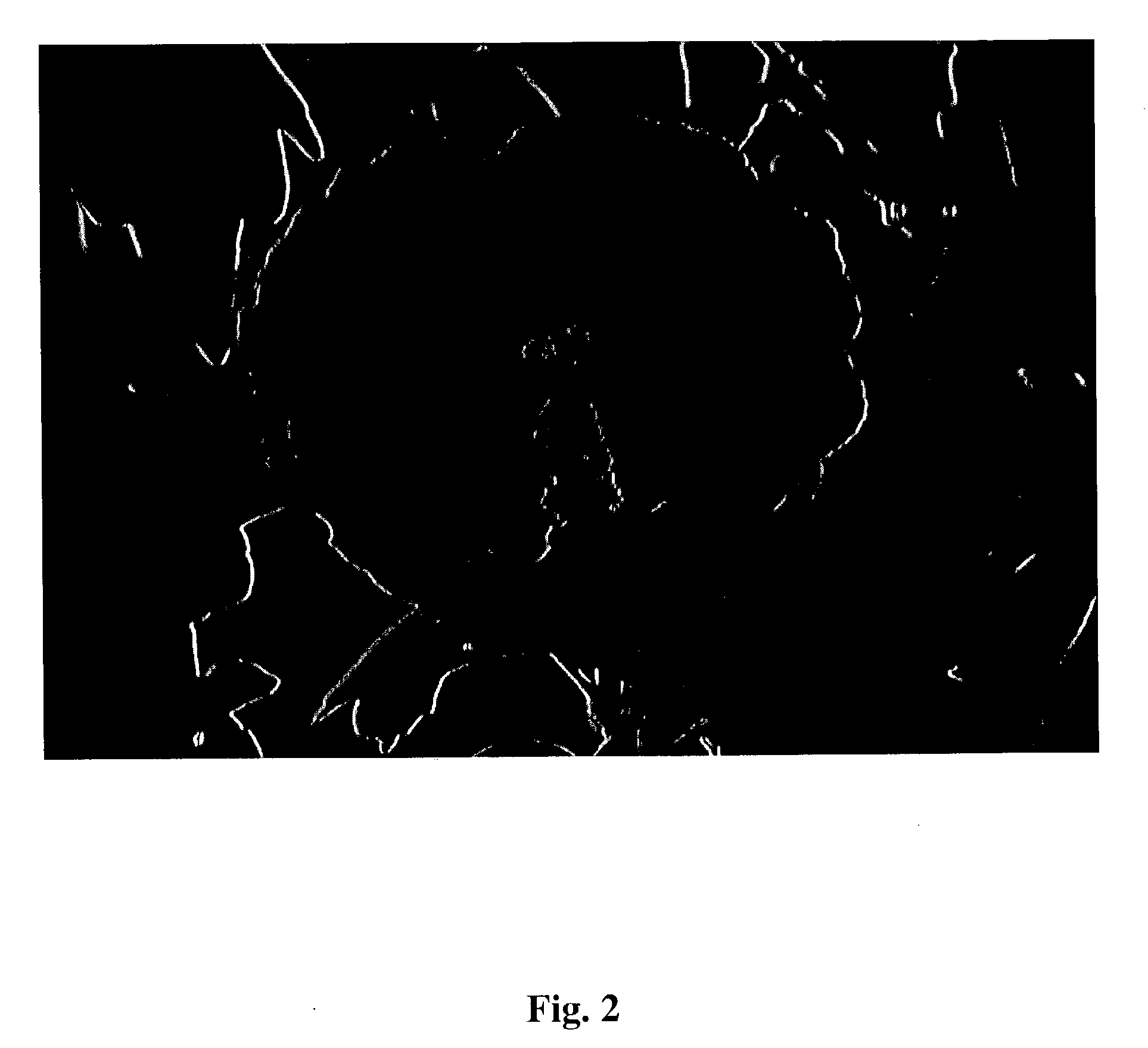 Methods and systems for objective measurement of video quality