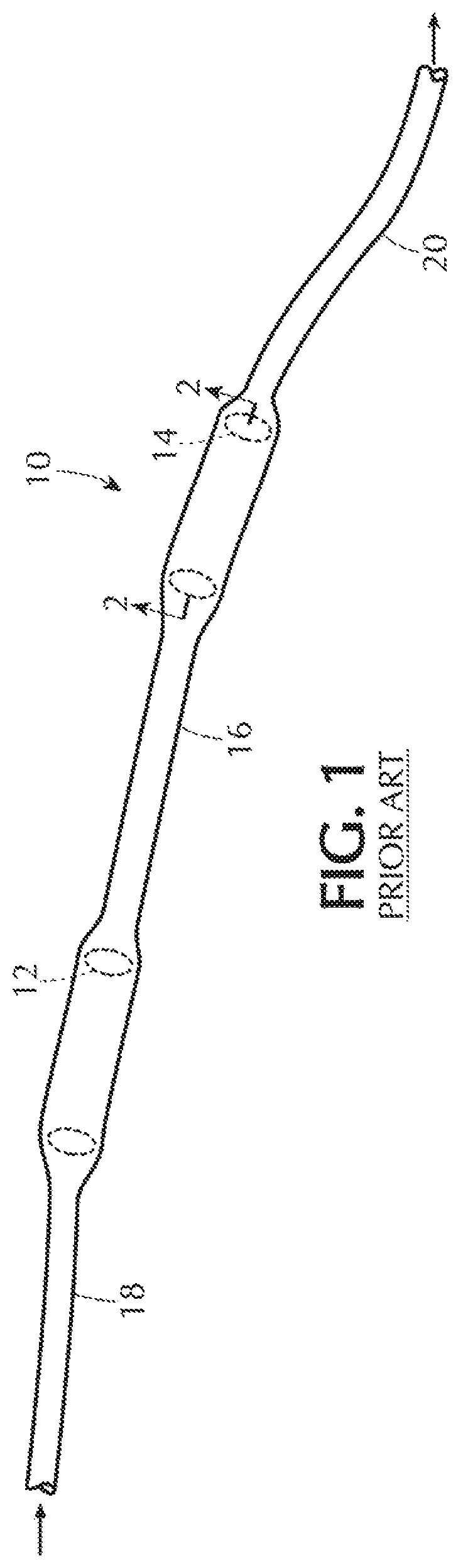 Self-offsetting implantable catheter system