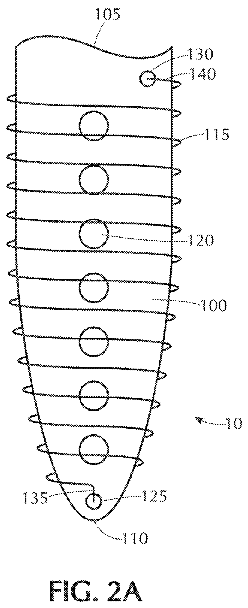 Self-offsetting implantable catheter system