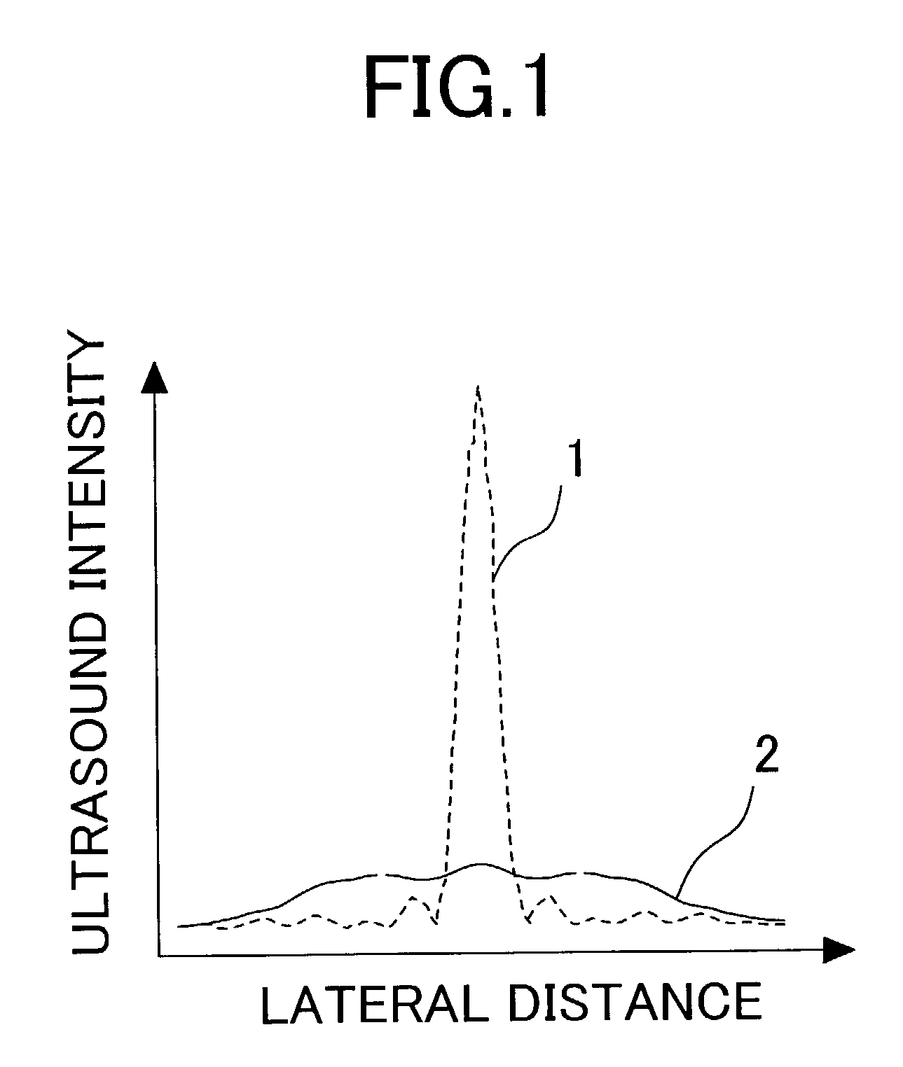 Ultrasonic apparatus for therapeutical use