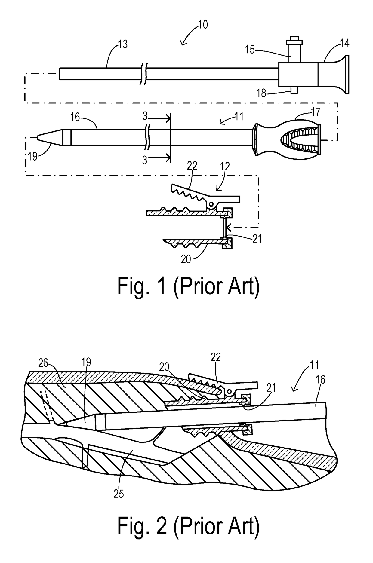 Endoscopic vessel harvester with blunt and active ring dissection