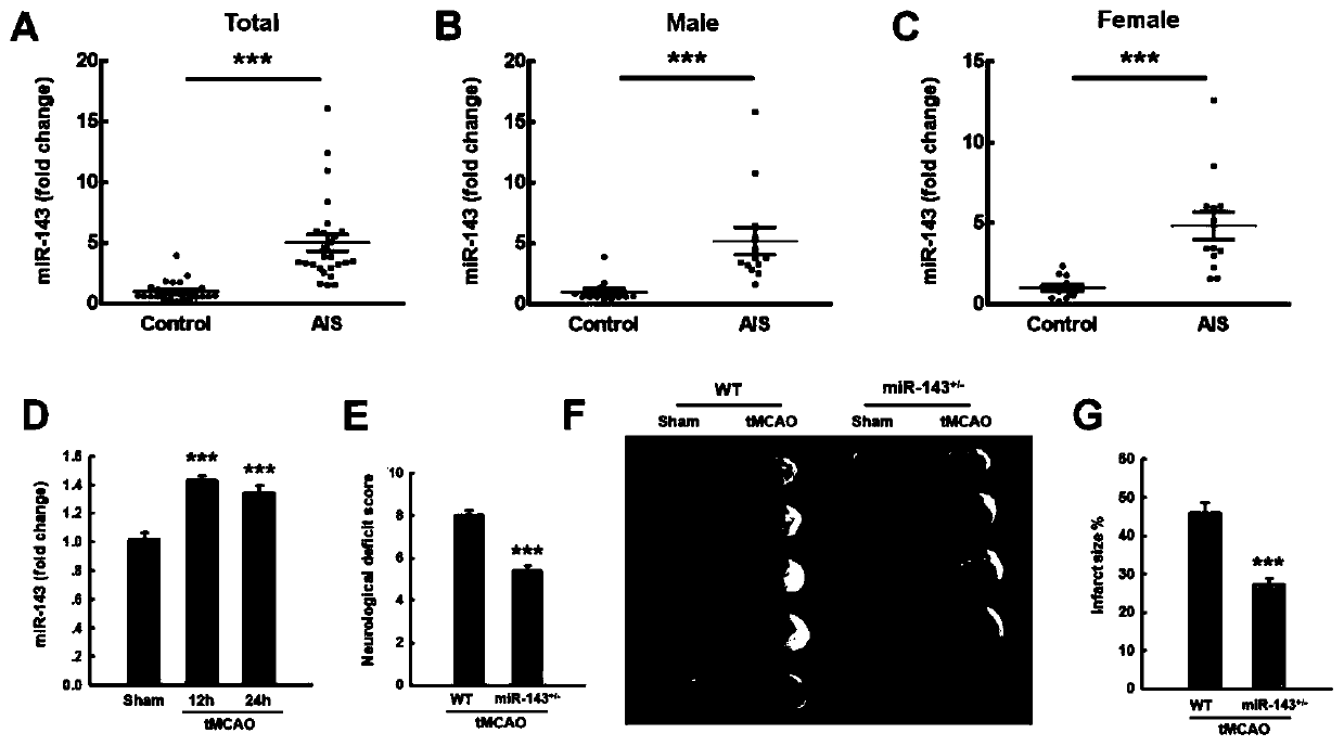 Application of circdlgap4 in the preparation of drugs for the treatment of stroke