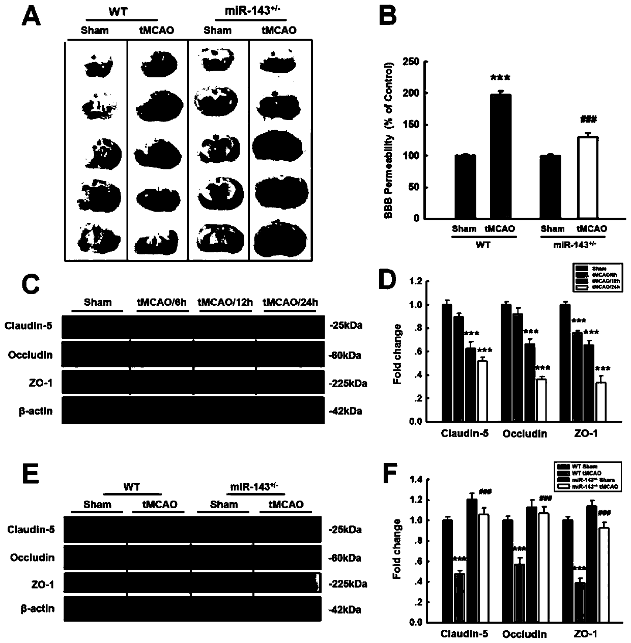 Application of circdlgap4 in the preparation of drugs for the treatment of stroke