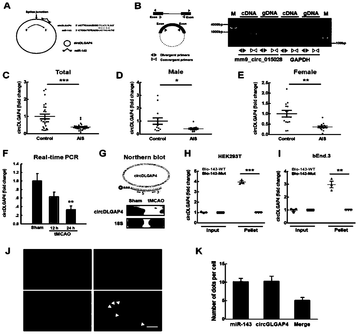 Application of circdlgap4 in the preparation of drugs for the treatment of stroke