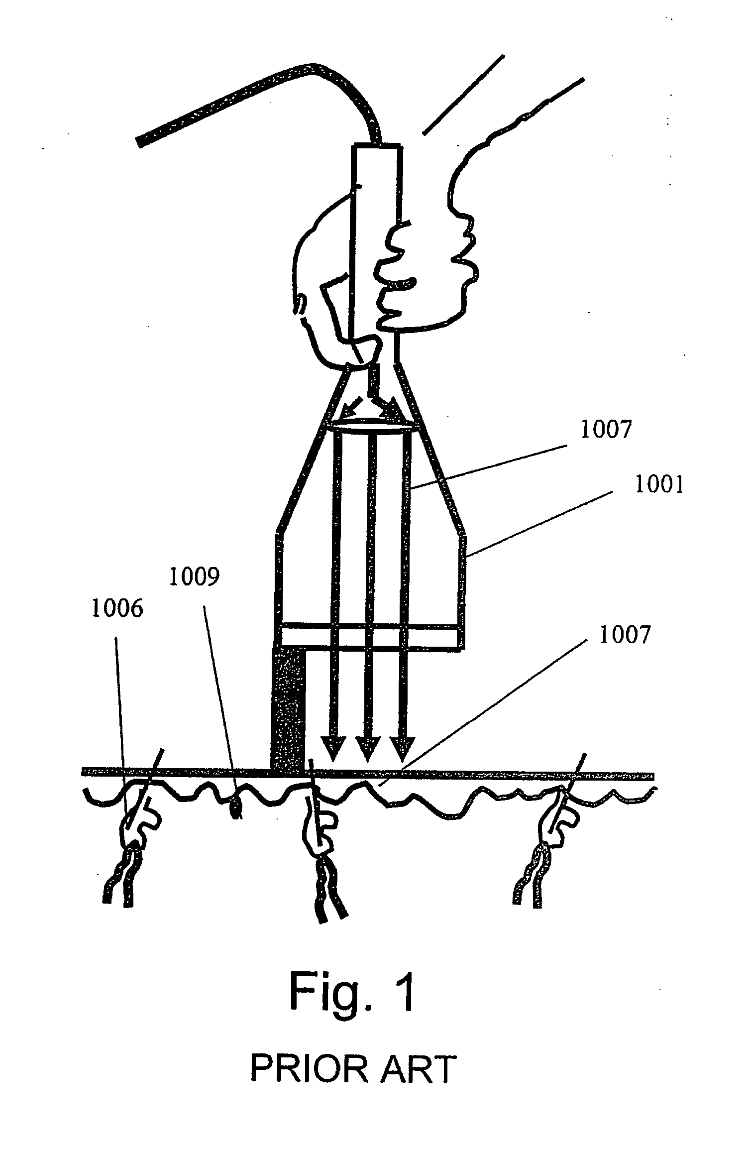 Method and apparatus for vacuum-assisted light-based treatments of the skin