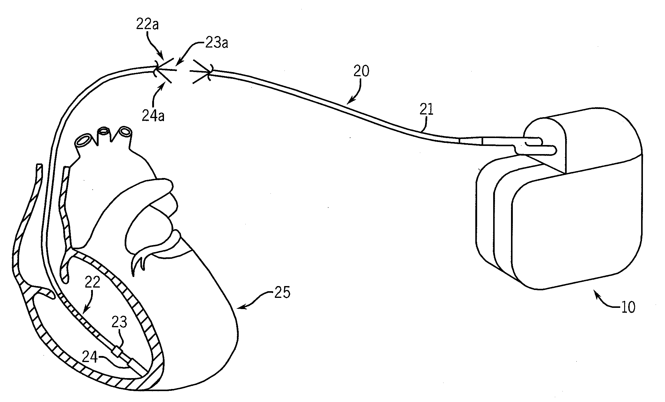 Method and apparatus for detection of lead conductor anomalies using dynamic electrical parameters