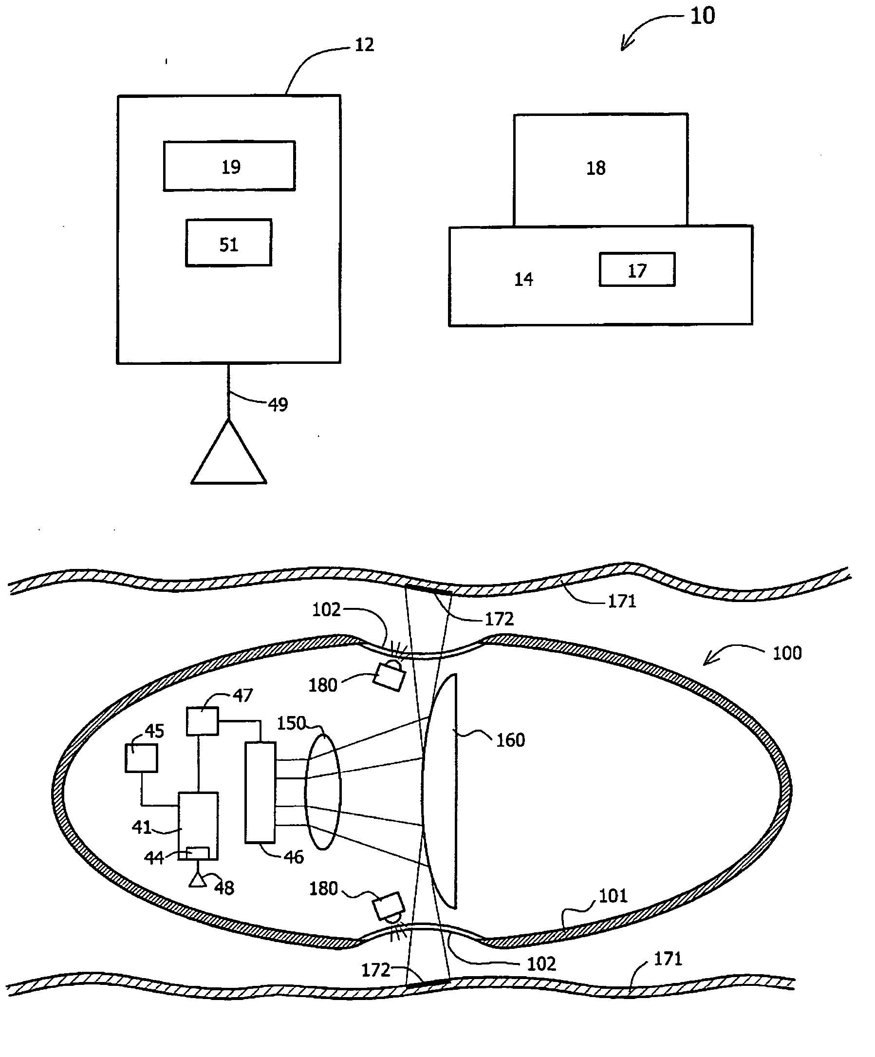 Device, system, and method for reducing image data captured in-vivo
