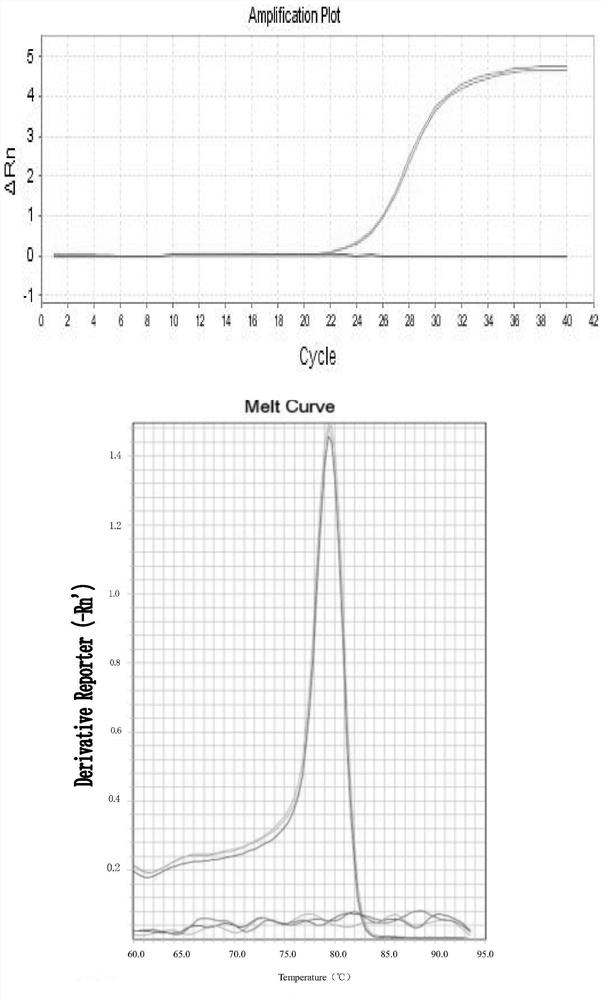 DPO primer set for detecting porcine transmissible gastroenteritis virus, kit containing the primer set and application thereof