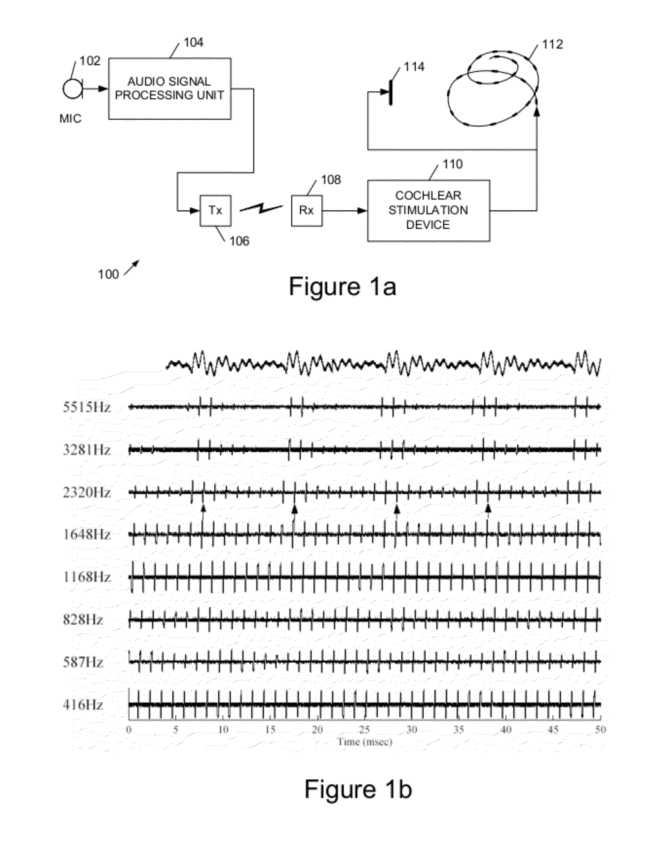 Cochlear implant apparatus and methods
