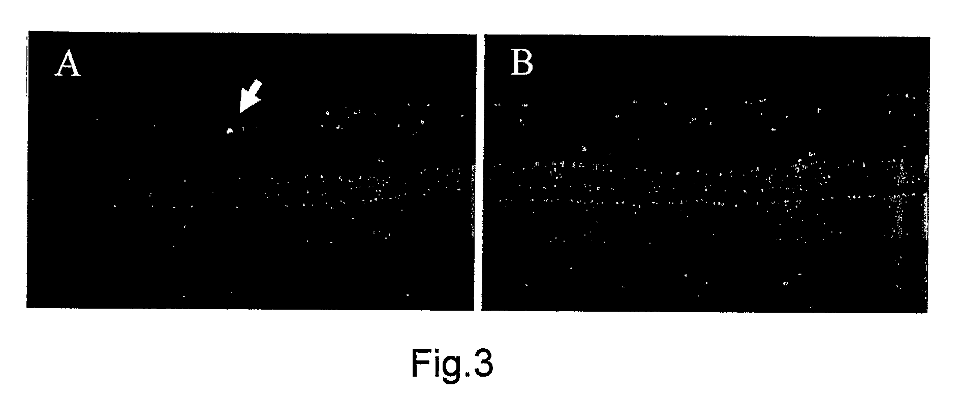 Staining composition for staining an ophthalmic membrane
