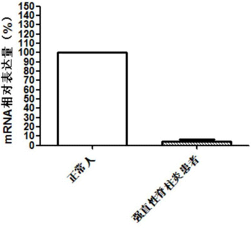 Application of KLHL22 gene and expression product thereof to preparation of diagnostic product
