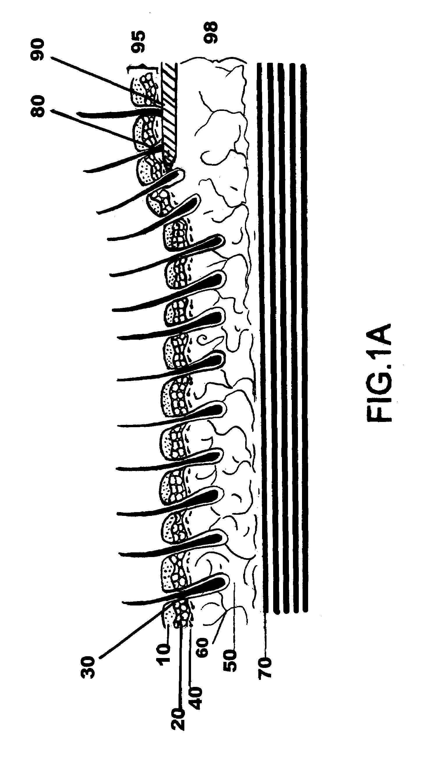 Facial tissue strengthening and tightening device and methods