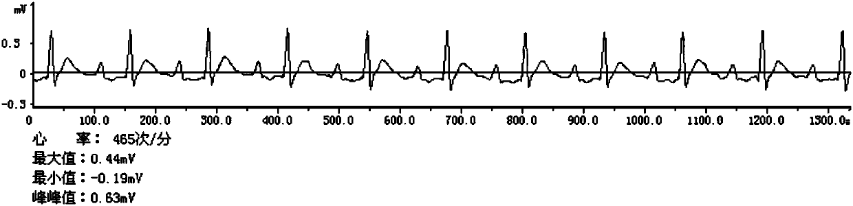 Chinese herbal medicine composition for relieving arrhythmia, and preparation method and application thereof